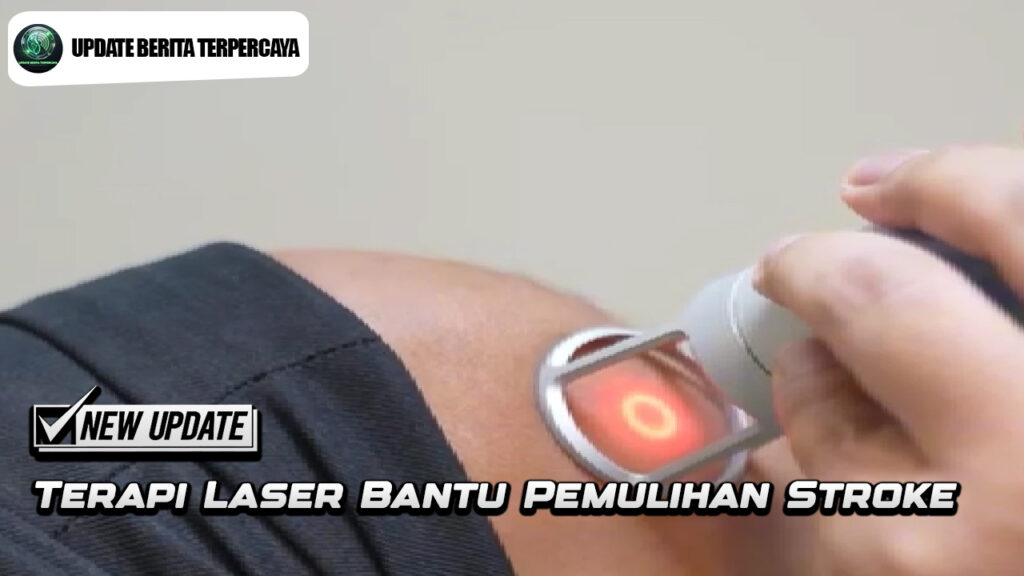Terapi Laser Bantu Pemulihan Stroke